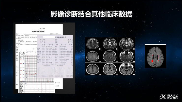 深度解析科大讯飞如何将智能影像技术应用于临床医疗？