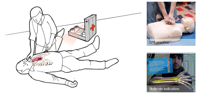 图示2-大联大诠鼎推出基于MicroVision的微激光扫描投影技术在医疗领域的应用方案示意图