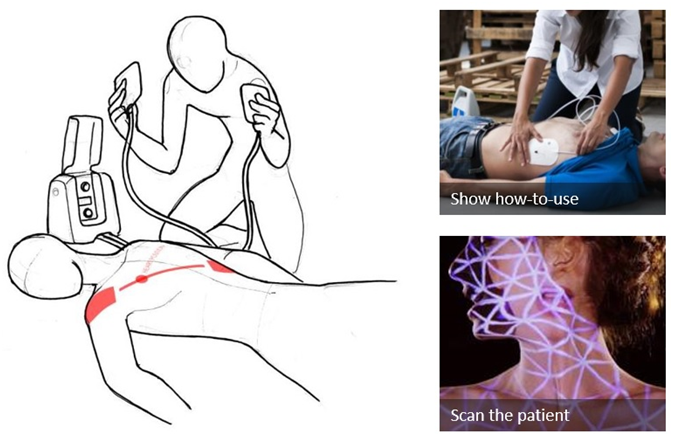 图示2-大联大诠鼎推出基于MicroVision的微激光扫描投影技术在医疗领域的应用方案示意图