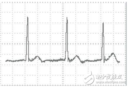 基于STM32芯片和TFT-LCD的便携式心电图仪设计