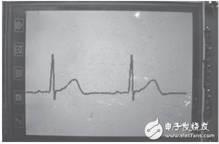 基于STM32芯片和TFT-LCD的便携式心电图仪设计