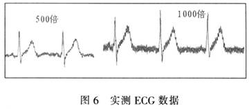 详解单片机在便携式无线心电监护仪中的作用5